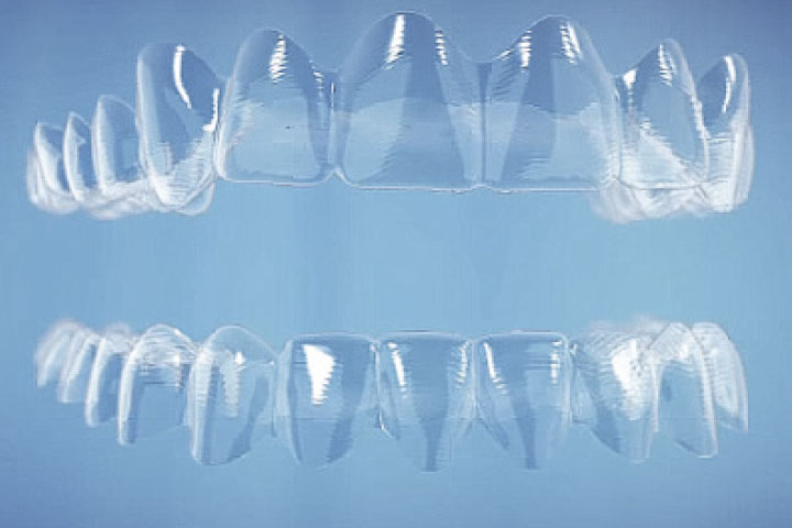 ferula invisalign