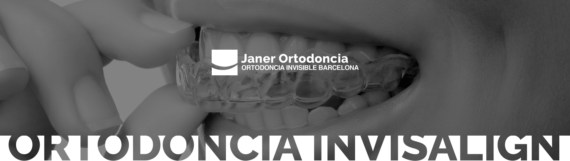 janer-invisalign