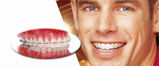 th_fd0b9a1c7f8985b1ea08ff5f1094917c_ceramica_1