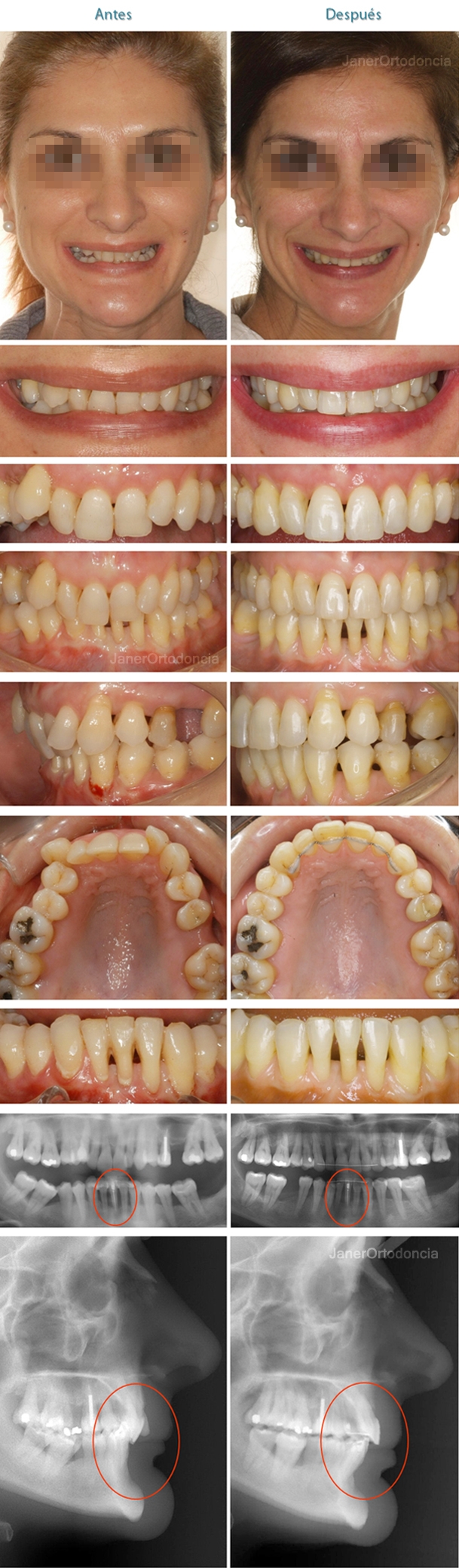 th_fd0b9a1c7f8985b1ea08ff5f1094917c_caso_periodoncia_m