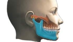 maxilar y mandíbula